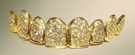 迪拜牙医用黄金钻石打造假牙_国际珠宝网-全球